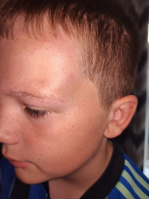 VICTIM: The 13-year-old boy who was attacked