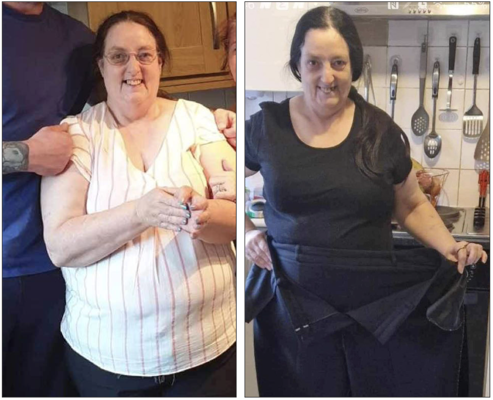 BEFORE AND AFTER: Lorraine Berry joined Slimming World in 2022