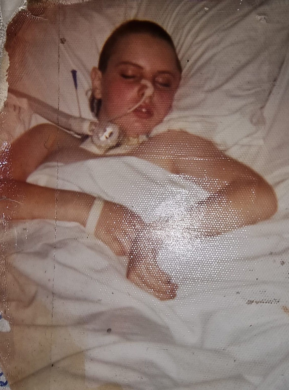 FIGHTING FOR LIFE: Carol Toner unconscious in hospital after being beaten by the British Army