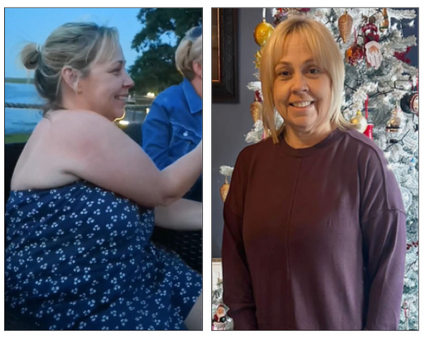 BEFORE AND AFTER: Christine McCann lost two stone with Slimming World