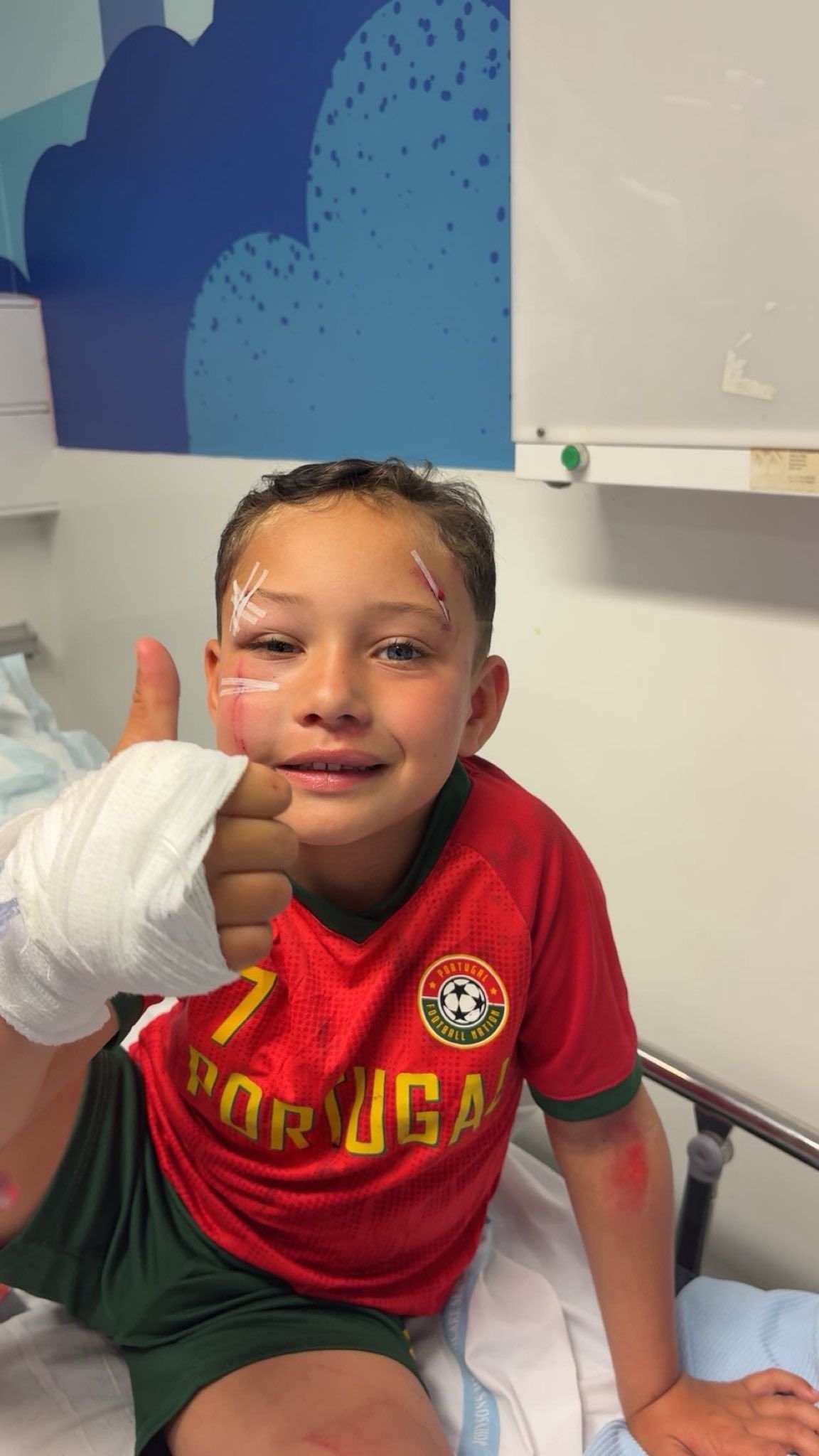 INJURED: Dre Hunte (4) was hit by an e-scooter last week