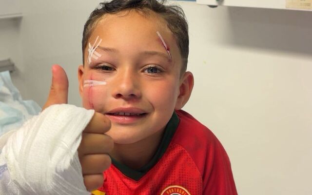 E-scooters: PSNI campaign as four-year-old boy injured in Twinbrook