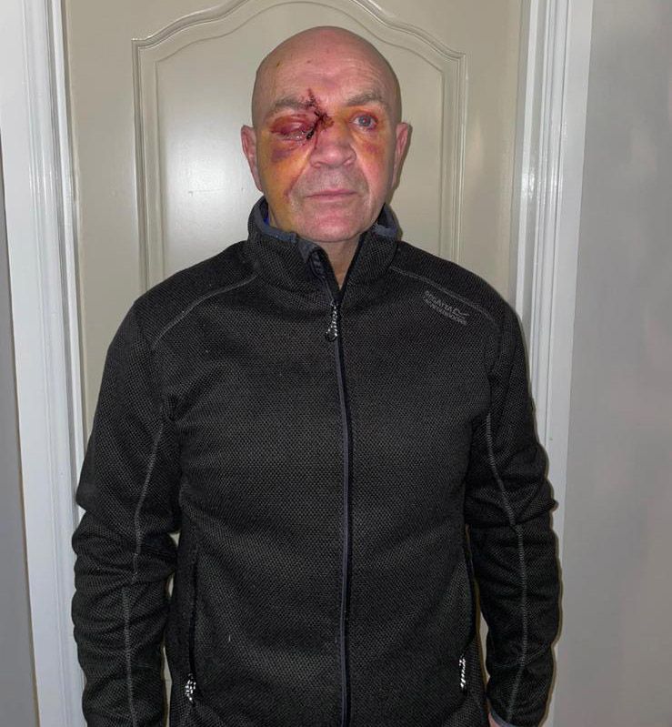 AFTERMATH: Fra McCaffrey