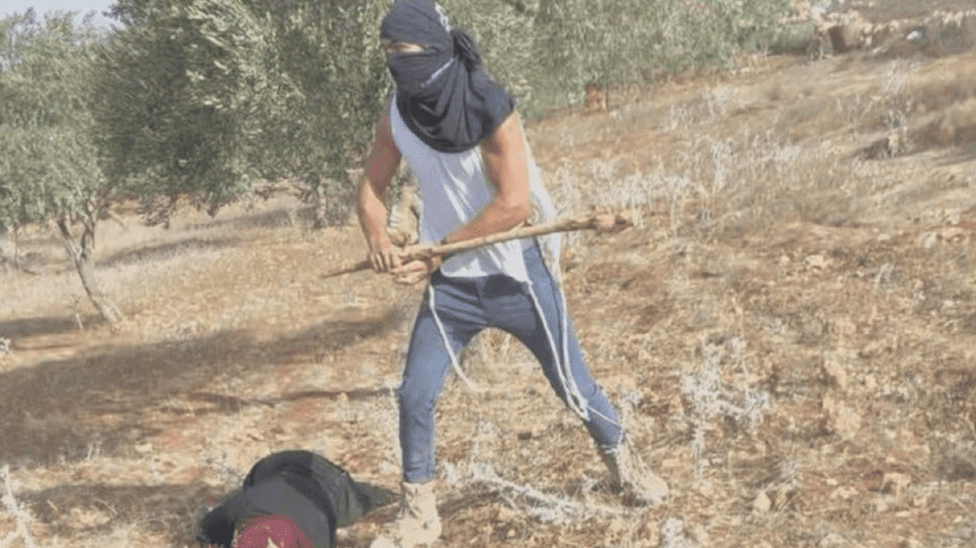 IMPUNITY: A Palestinian woman lies with severe head injuries after being savagely clubbed by a settler while harvesting olives