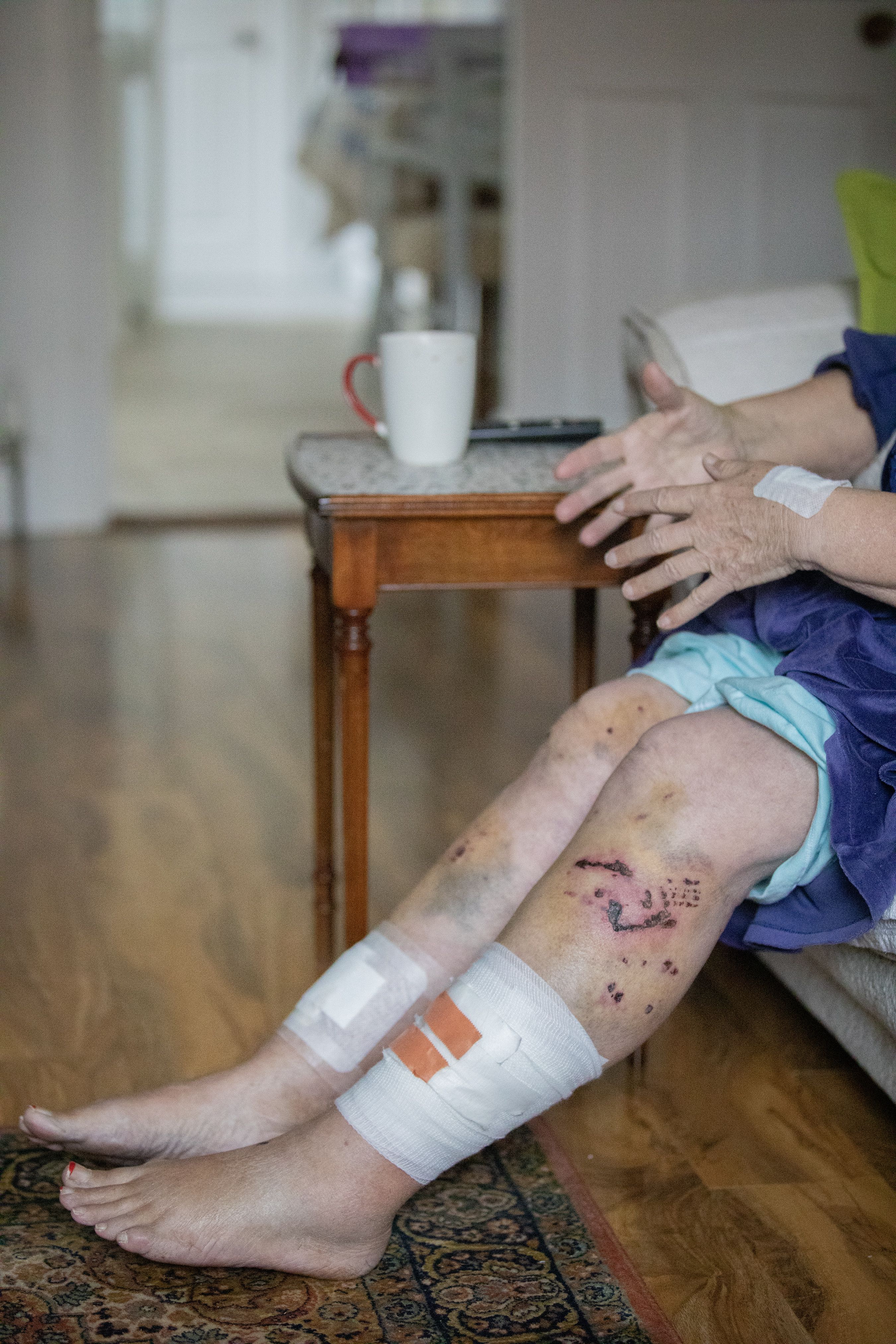 Sheila suffered bites to her legs and hands