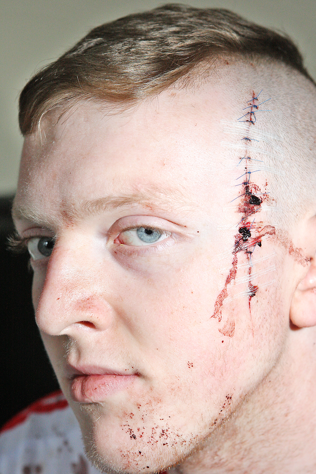 Tomás Magennis was held down on the sofa and slashed with a  Stanley knife. The appalling wound required 13 stitches