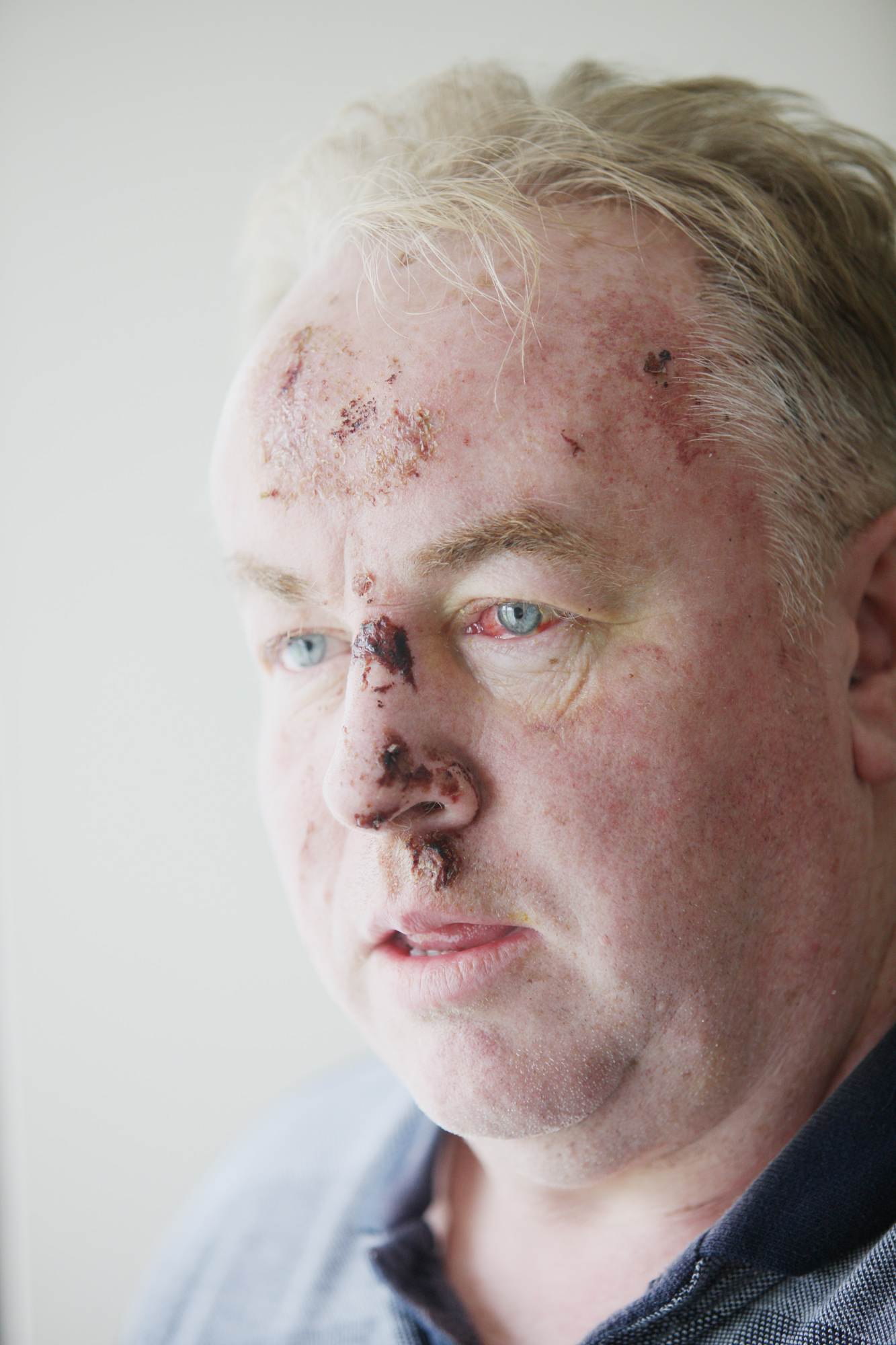 ATTACKED: Paddy McGill