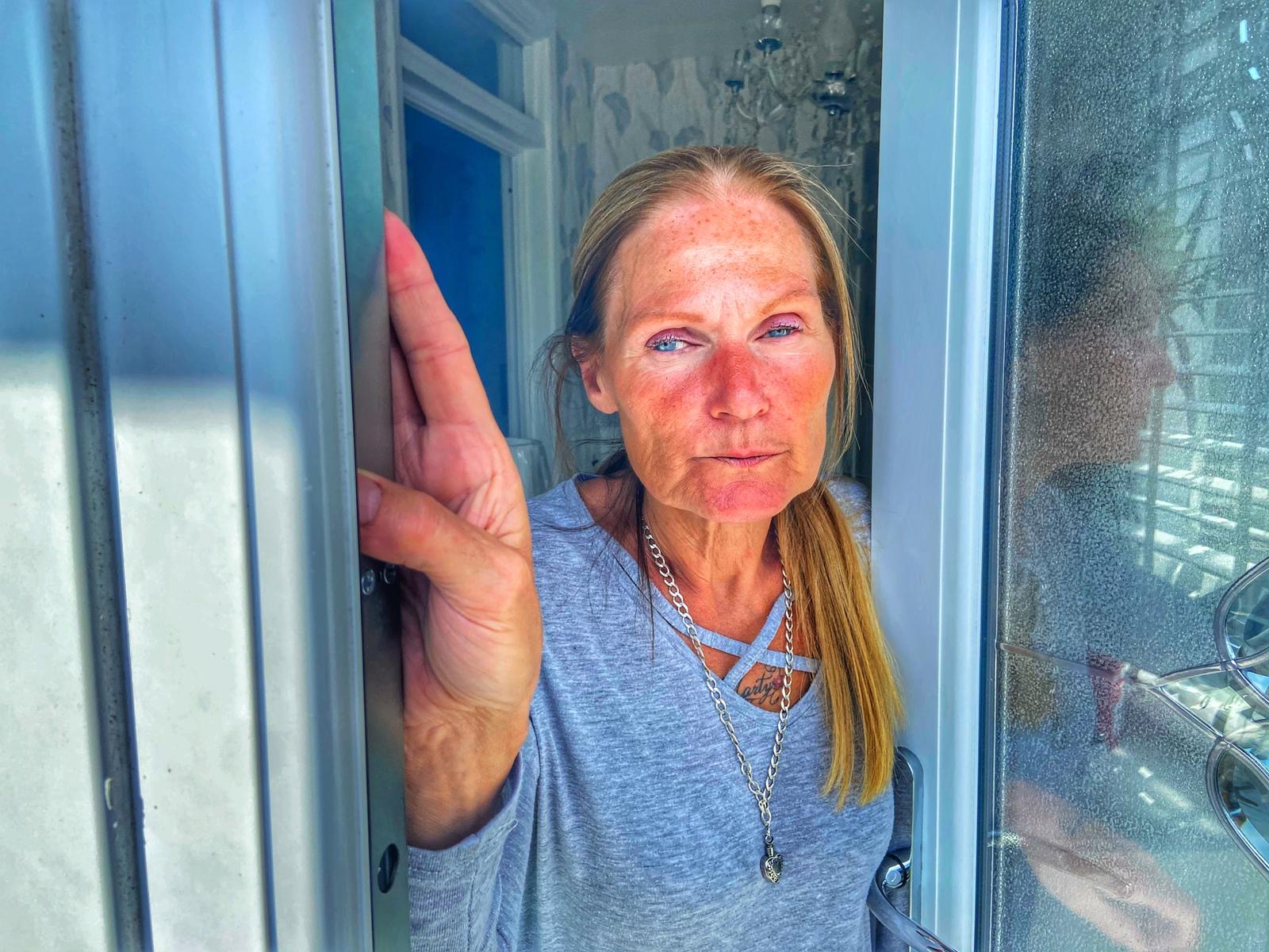BATTERED: Lorraine Kavanagh recounts savagery of attackers behind home incursion